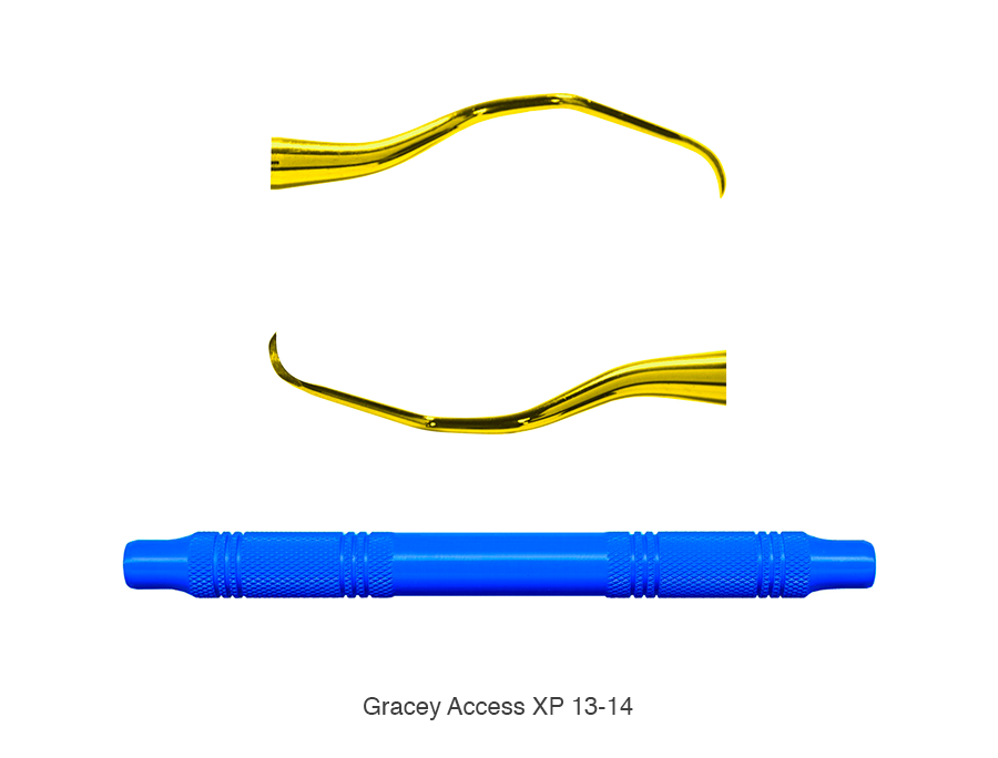Gracey Access XP