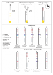 ImmuView® S. pneumoniae and L. pneumophila