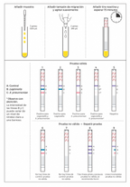 ImmuView® S. pneumoniae and L. pneumophila