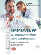 ImmuView® S. pneumoniae and L. pneumophila