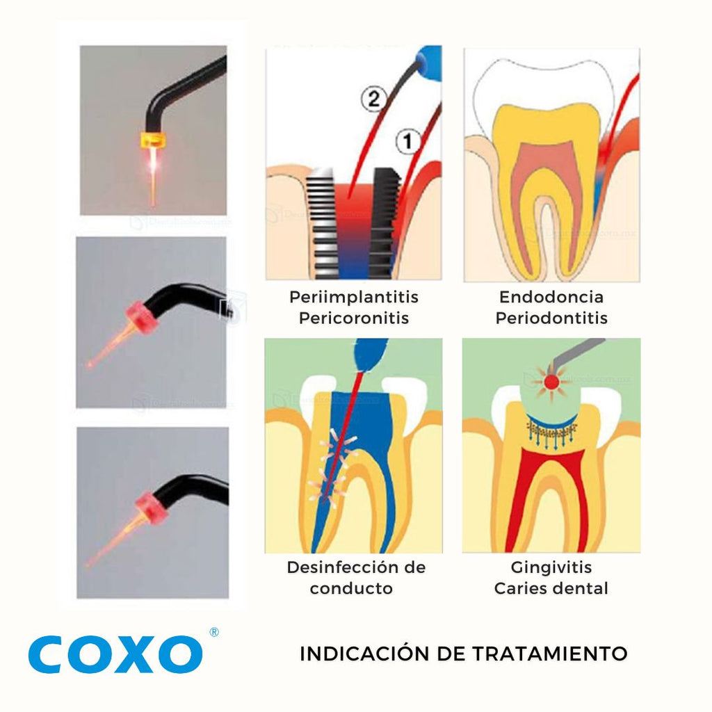 Coxo Z&H – Lámpara LED Fotocurado