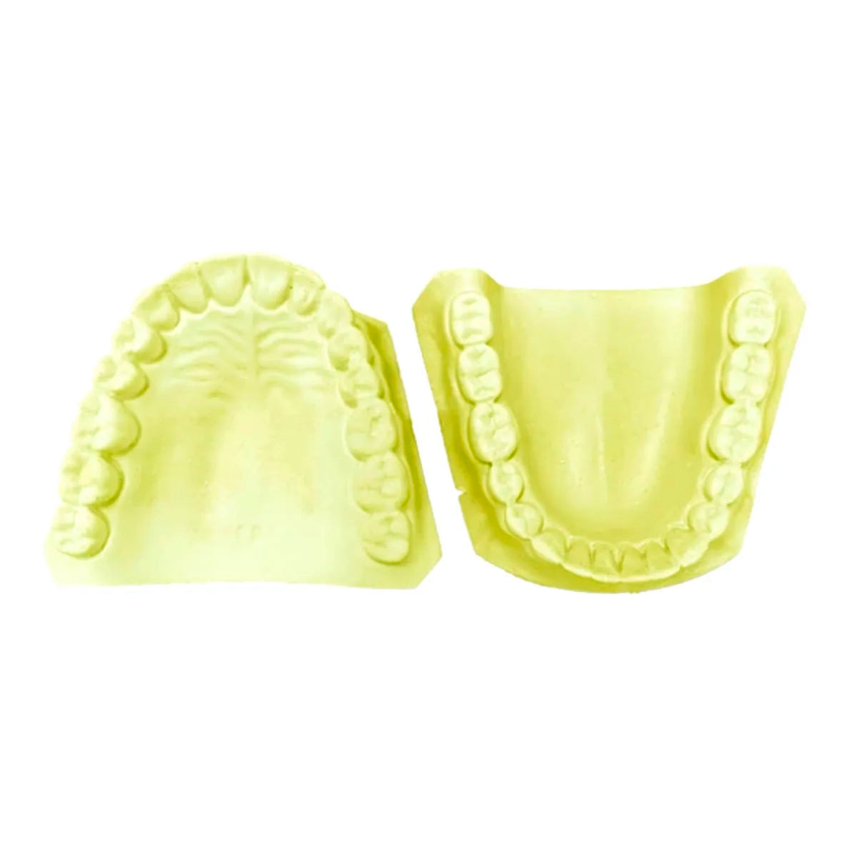 MODELO DE YESO DENTADO