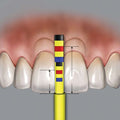 PAPREF__papilla_central_2