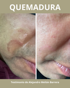 Crema Regeneradora y Protectora Natural Pielawén | Reparación Intensiva de la Piel – Chiloé