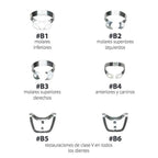 SET DE CLAMPS BRINKER HYGENIC