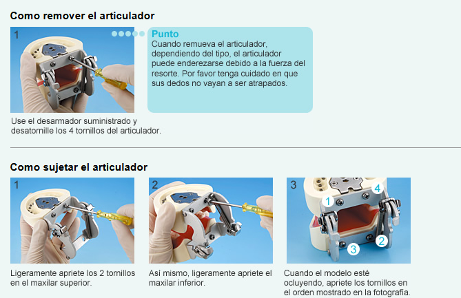 ARTICULADOR PARA MAXILAR TIPO FEM - Parejalecarosch