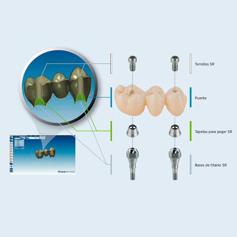 Ceramill M-Plant | Software