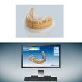 Ceramill M-Splint | Software para férulas