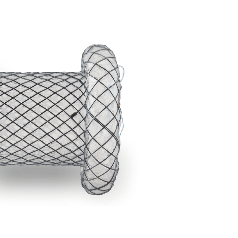 Stent20Pseudoquiste20Pancreatico20-2002.png