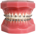MODELO - TYPODONTO H4