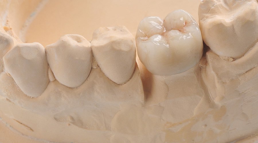 Yeso-ventura-ivory-rock-IV-21