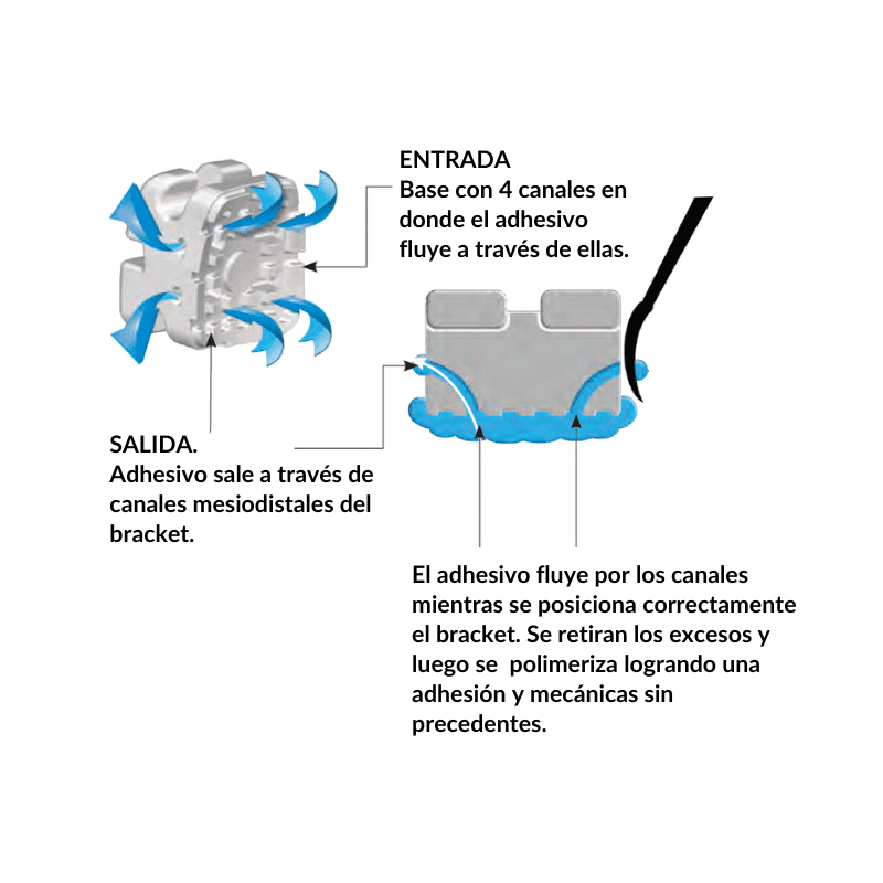 Kit Bracket Cerámico Agility .022 | G&H Orthodontics