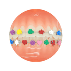 Ligadura DesignerTies | G&H Orthodontics