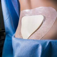 euroderm-foam-sacral-2-200×200