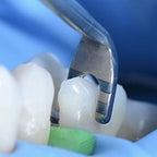 lm-arte-cusp-misura-clinical