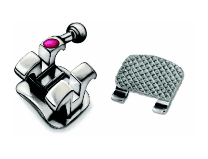Reposición Brackets Metálicos Gemini MBT