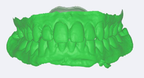 biteSTL-2