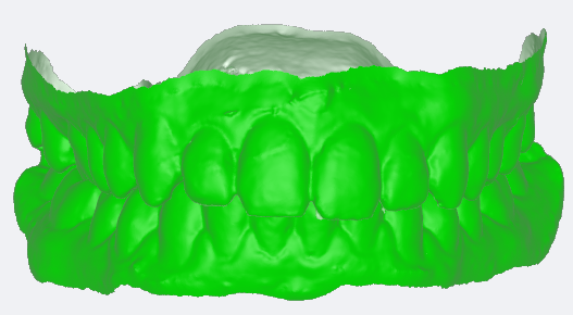 biteSTLpng