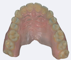 oclusal 2