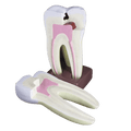 Macromodelo Molar Magnético Machtig