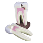 Macromodelo Molar Magnético Machtig