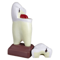 Macromodelo Premolar Magnético Machtig