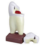 Macromodelo Premolar Magnético Machtig