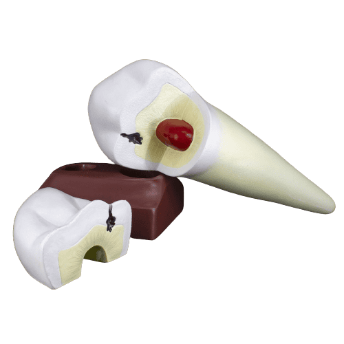 Macromodelo_Premolar_Magnético_Machtig-removebg-preview
