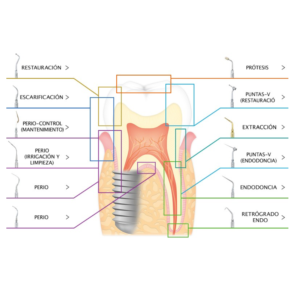 Punta de Ultrasonido E7 Endodoncia NSK - eksadental