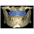 romexis 3D_4